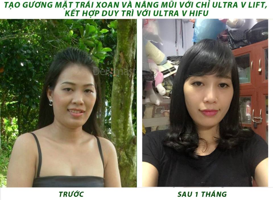 khach-hang-myspa-dermaster- viet- nam