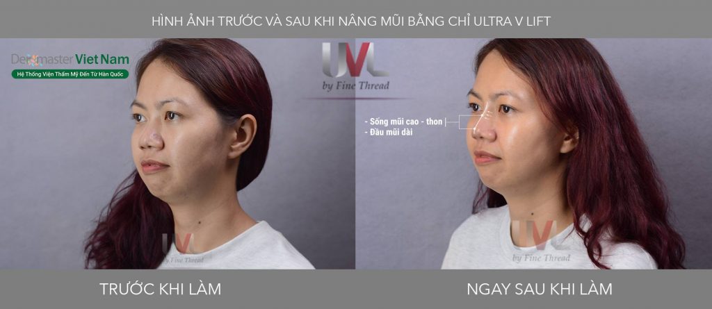 khach-hang-myspa-dermaster- viet- nam
