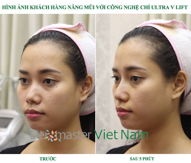 khach-hang-myspa-dermaster- viet- nam