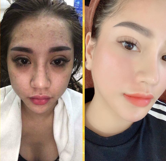 khach-hang-cua-myspa-diamond-cocoon