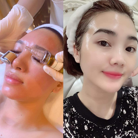 khach-hang-cua-myspa-diamond-cocoon