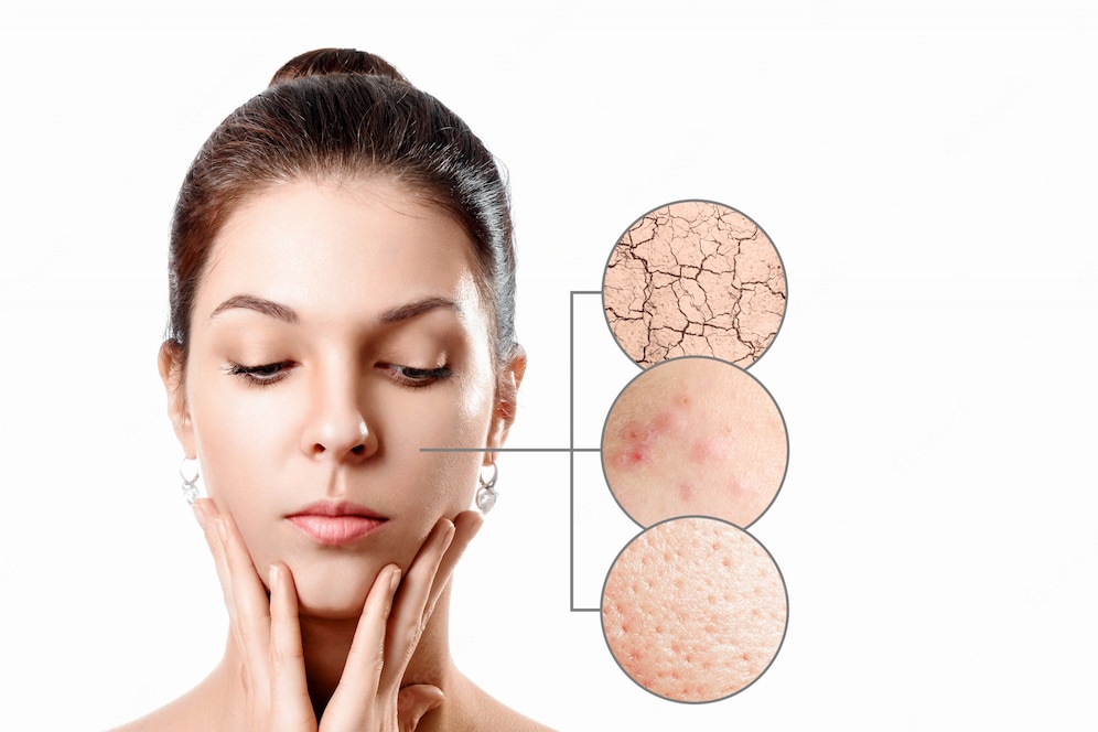 Soi da giúp phát hiện các vấn đề về da