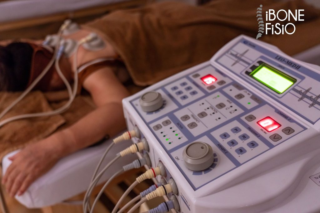 Sử dụng công nghệ điện xung trị liệu trong điều trị tại iBone Fisio