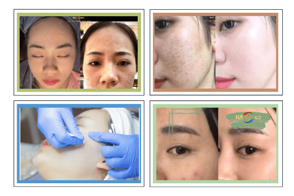 Dịch vụ chăm sóc da tại NA