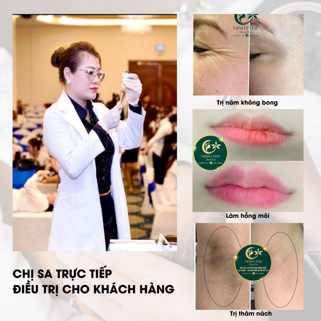 Một số hình ảnh các ca điều trị của khách hàng tại Minh Châu Beauty