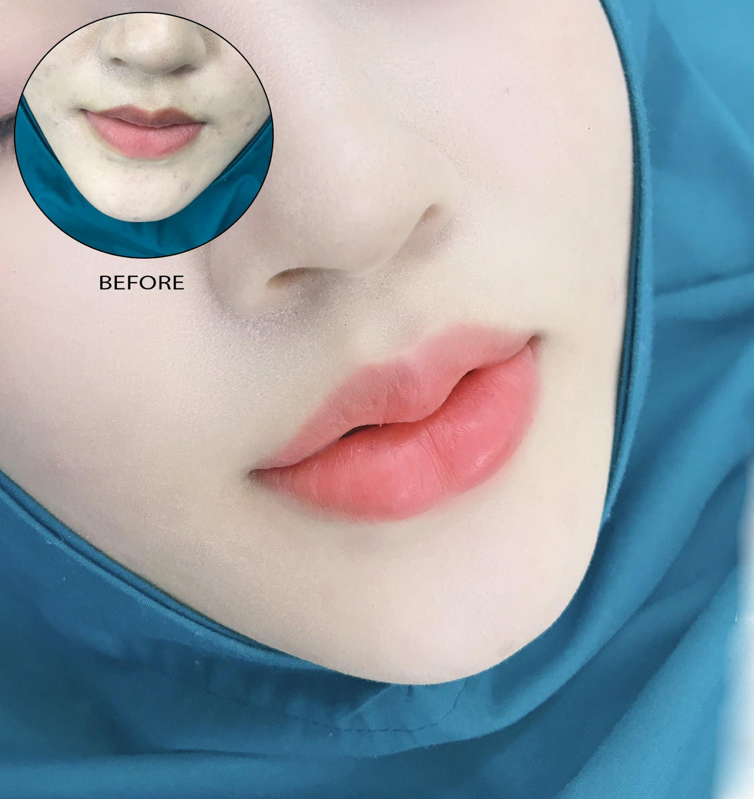 Dịch vụ phun xăm thẩm mỹ ở Thu Hương Beauty & Clinic